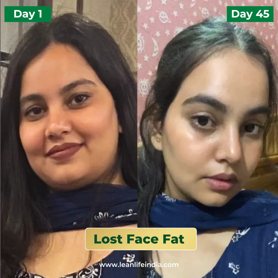 Endurix with capsules - Image 2